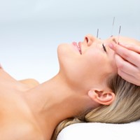 En introduksjon til akupunktur