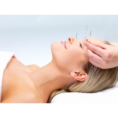 En introduksjon til akupunktur